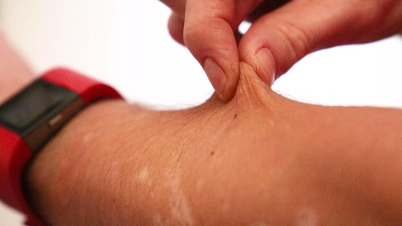 1.3 Biggest Challenges in CAD Bioengineering | Special Report