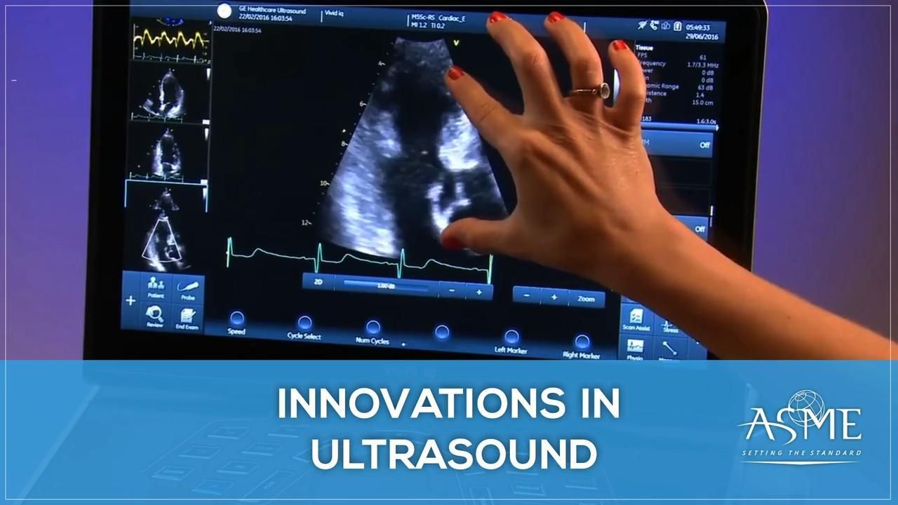 Innovations in Ultrasound